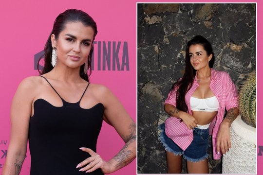 Skyrybas išgyvenusi S. Šernė – atvirai apie kūno pokyčius ir medikų pagalbą: prakalbo apie vaistus