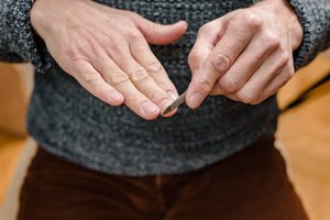 Trūksta vitaminų? Pasakė, ką iš tikrųjų reiškia balti taškeliai ant nagų