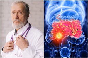Onkologai įvardijo itin svarbią ribą – 45 metai: ką privalu padaryti sulaukus šio amžiaus?
